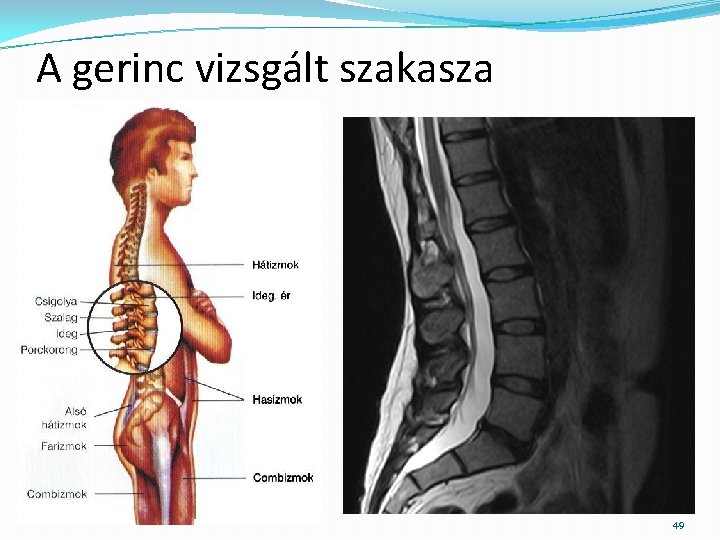 A gerinc vizsgált szakasza 49 