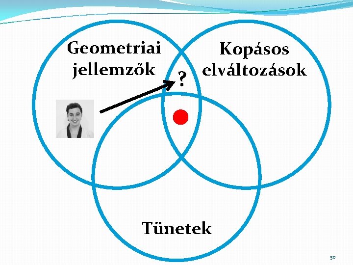 Geometriai jellemzők ? Kopásos elváltozások Tünetek 50 