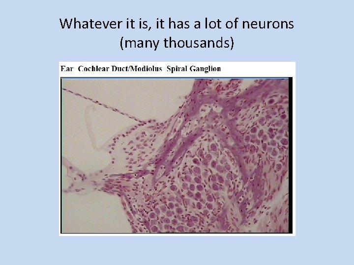 Whatever it is, it has a lot of neurons (many thousands) 