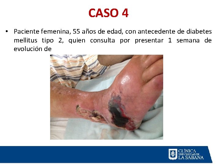 CASO 4 • Paciente femenina, 55 años de edad, con antecedente de diabetes mellitus