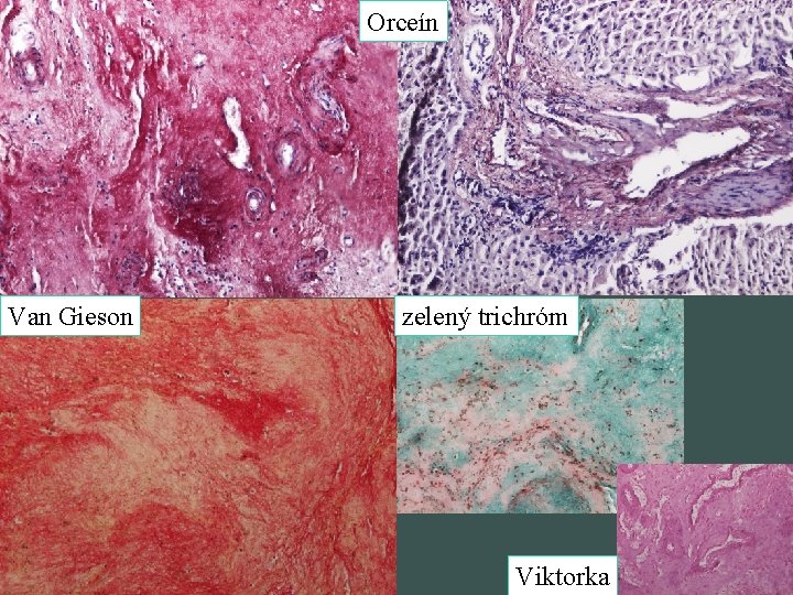 Orceín Van Gieson zelený trichróm Viktorka 