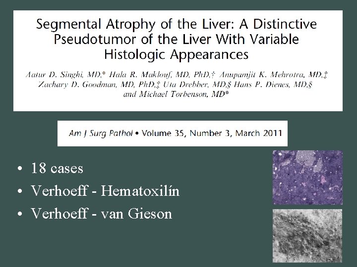  • 18 cases • Verhoeff - Hematoxilín • Verhoeff - van Gieson 