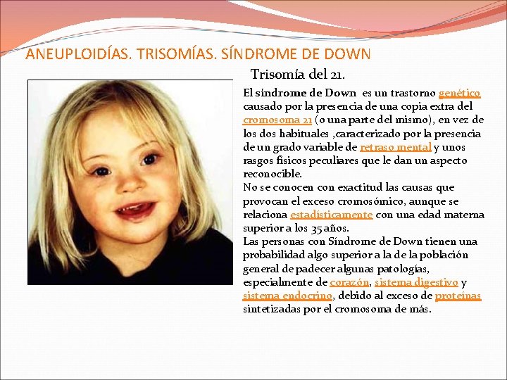 ANEUPLOIDÍAS. TRISOMÍAS. SÍNDROME DE DOWN Trisomía del 21. El síndrome de Down es un