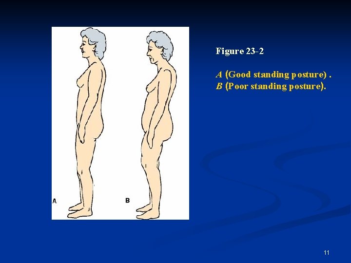 Figure 23 -2 A (Good standing posture). B (Poor standing posture). 11 