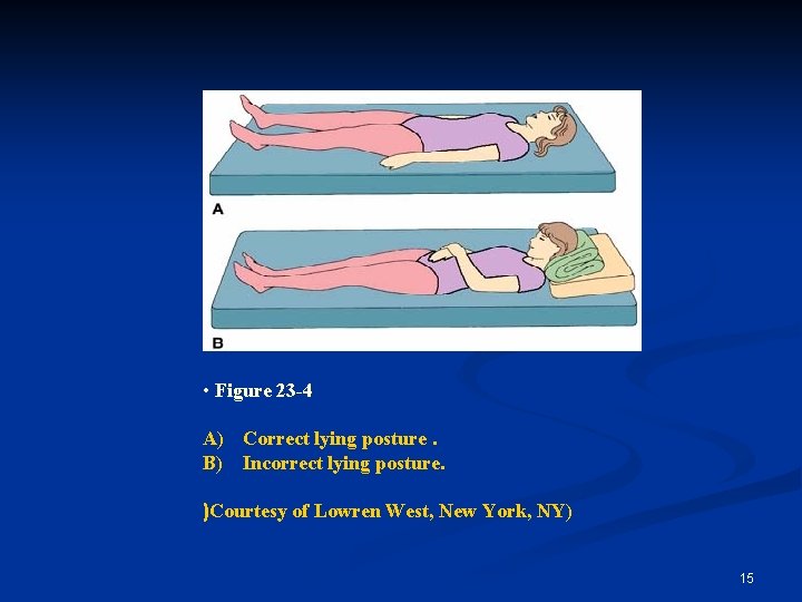  • Figure 23 -4 A) Correct lying posture. B) Incorrect lying posture. )Courtesy