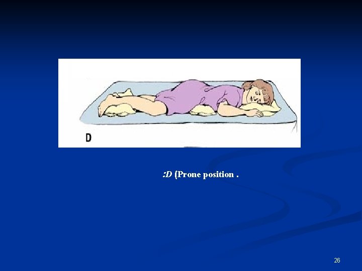 : D (Prone position. 26 