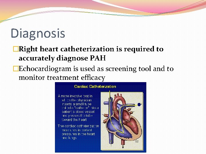Diagnosis �Right heart catheterization is required to accurately diagnose PAH �Echocardiogram is used as