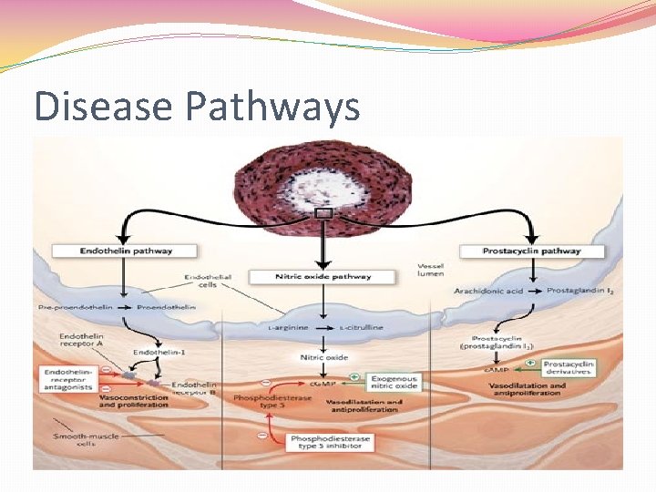 Disease Pathways 