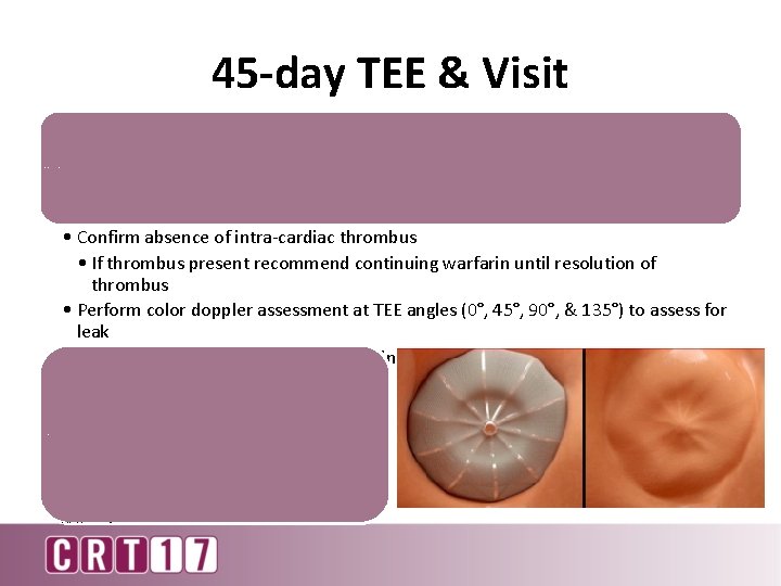 45 -day TEE & Visit Assess Watchman device with TEE • Confirm absence of