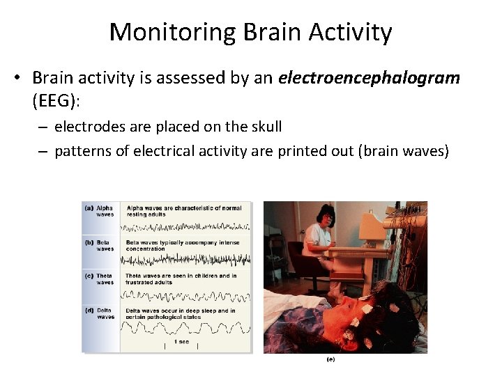 Monitoring Brain Activity • Brain activity is assessed by an electroencephalogram (EEG): – electrodes