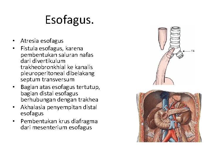 Esofagus. • Atresia esofagus • Fistula esofagus, karena pembentukan saluran nafas dari divertikulum trakheobronkhial