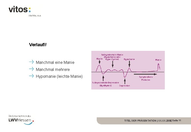 Verlauf// Manchmal eine Manie Manchmal mehrere Hypomanie (leichte Manie) TITEL DER PRÄSENTATION | XX.