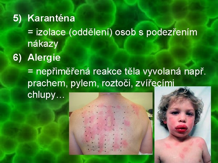 5) Karanténa = izolace (oddělení) osob s podezřením nákazy 6) Alergie = nepřiměřená reakce