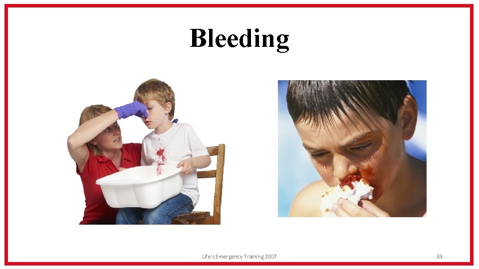 Bleeding Life's Emergency Training 2007 33 