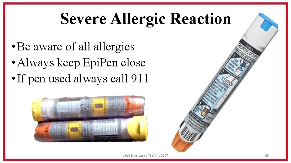Severe Allergic Reaction • Be aware of allergies • Always keep Epi. Pen close