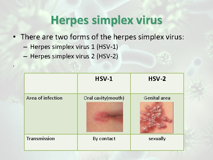 Herpes simplex virus • There are two forms of the herpes simplex virus: –