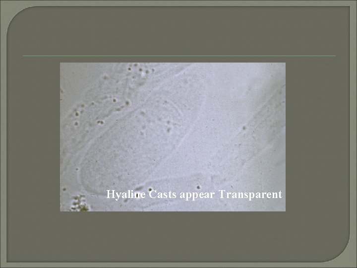 Hyaline Casts appear Transparent 