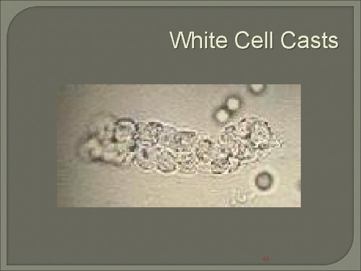 White Cell Casts 46 