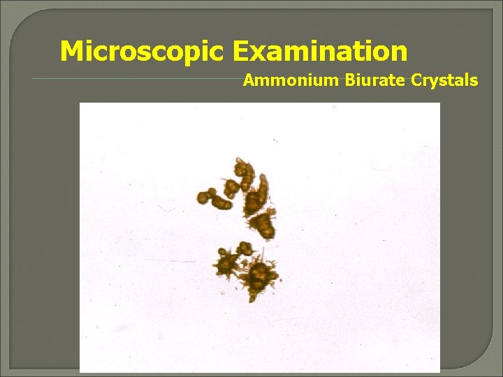 Microscopic Examination Ammonium Biurate Crystals 