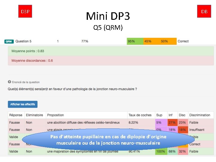 D 3 P Mini DP 3 Q 5 (QRM) Pas d’atteinte pupillaire en cas