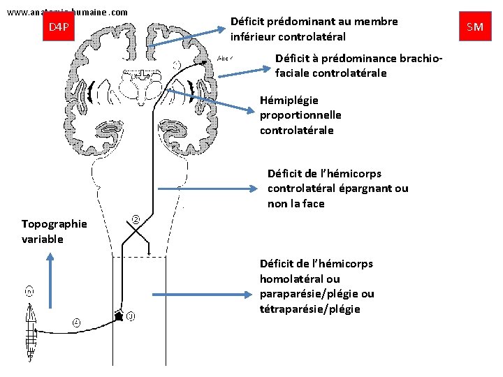 www. anatomie-humaine. com D 4 P Déficit prédominant au membre inférieur controlatéral Déficit à