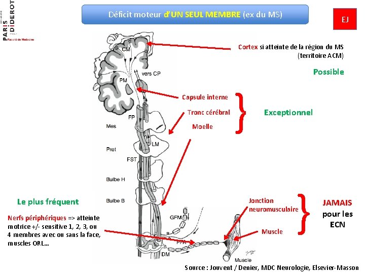 Déficit moteur d’UN SEUL MEMBRE (ex du MS) EJ Cortex si atteinte de la