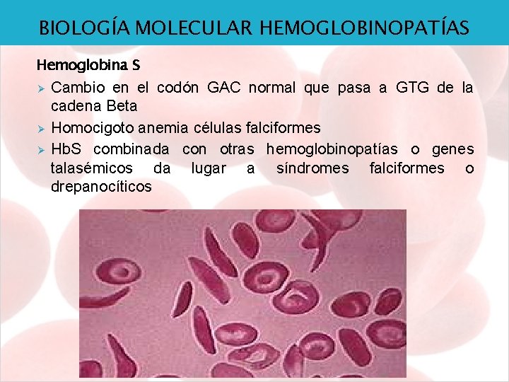 BIOLOGÍA MOLECULAR HEMOGLOBINOPATÍAS Hemoglobina S Ø Ø Ø Cambio en el codón GAC normal