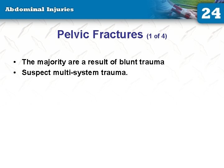 Pelvic Fractures (1 of 4) • The majority are a result of blunt trauma Pelvic Fractures (1 of 4) • The majority are a result of blunt trauma