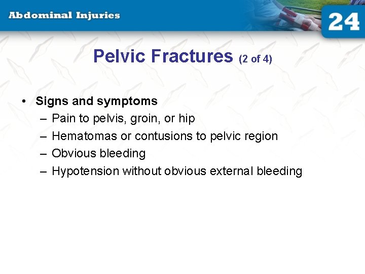Pelvic Fractures (2 of 4) • Signs and symptoms – Pain to pelvis, groin,