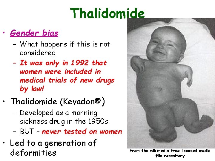 Thalidomide • Gender bias – What happens if this is not considered – It