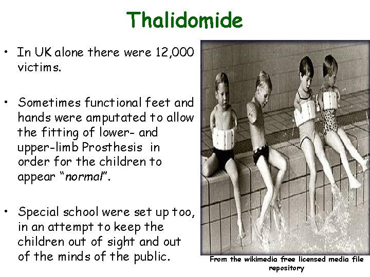 Thalidomide • In UK alone there were 12, 000 victims. • Sometimes functional feet