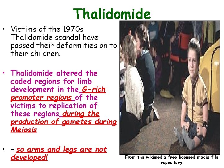 Thalidomide • Victims of the 1970 s Thalidomide scandal have passed their deformities on