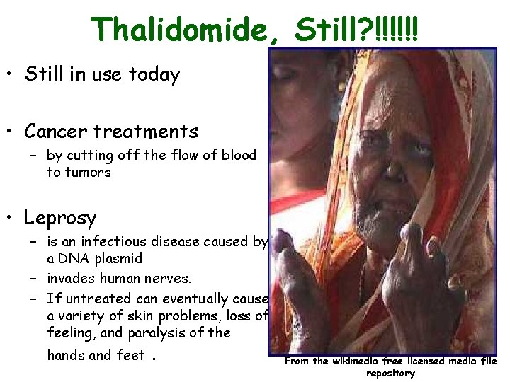 Thalidomide, Still? !!!!!! • Still in use today • Cancer treatments – by cutting