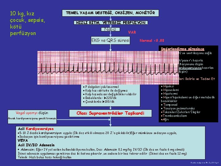 10 kg, kız çocuk, sepsis, kötü perfüzyon TEMEL YAŞAM DESTEĞİ, OKSİJEN, MONİTÖR HIZLI RİTM,