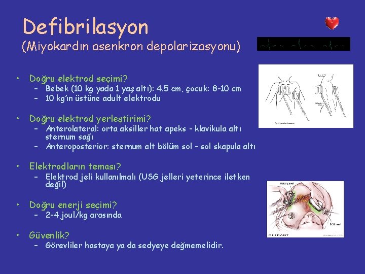 Defibrilasyon (Miyokardın asenkron depolarizasyonu) • Doğru elektrod seçimi? • Doğru elektrod yerleştirimi? • Elektrodların