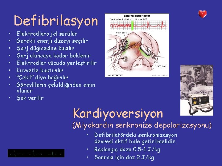 Defibrilasyon • • • Elektrodlara jel sürülür Gerekli enerji düzeyi seçilir Şarj düğmesine basılır