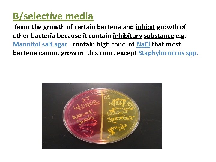 B/selective media favor the growth of certain bacteria and inhibit growth of other bacteria
