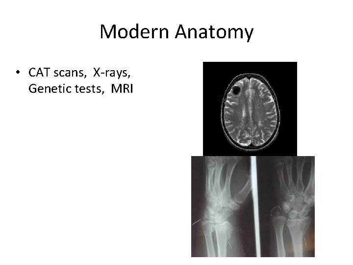 Modern Anatomy • CAT scans, X-rays, Genetic tests, MRI 