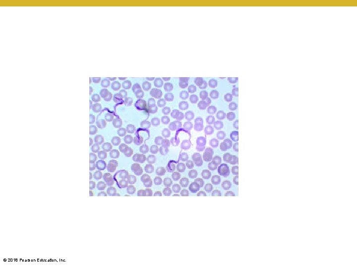 © 2018 Pearson Education, Inc. 