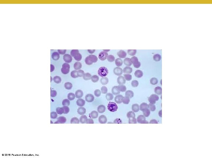 © 2018 Pearson Education, Inc. 