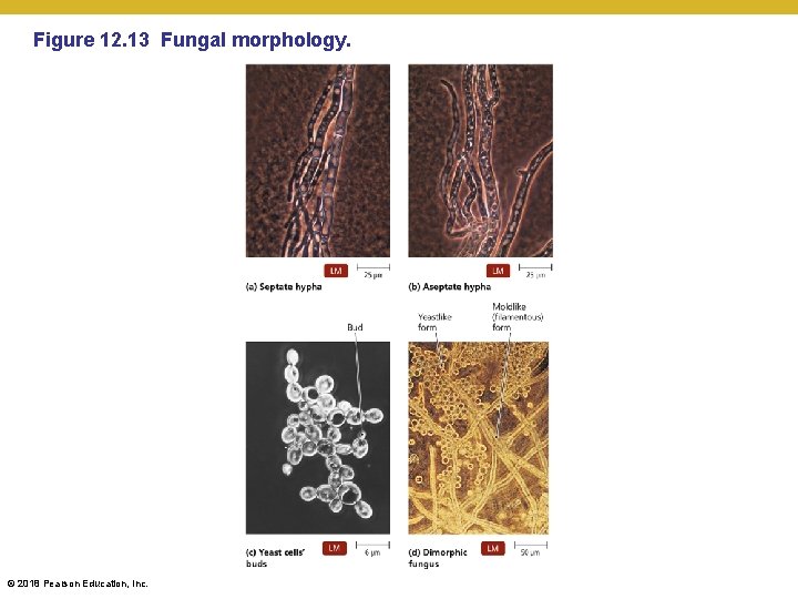 Figure 12. 13 Fungal morphology. © 2018 Pearson Education, Inc. 