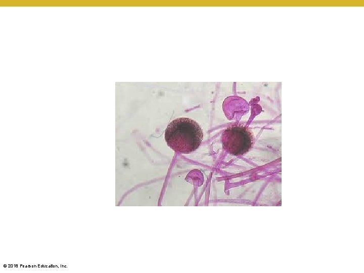 © 2018 Pearson Education, Inc. 