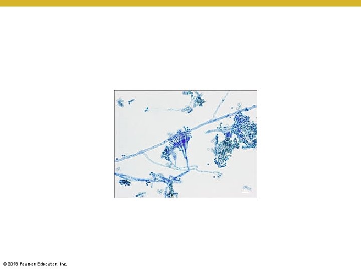 © 2018 Pearson Education, Inc. 