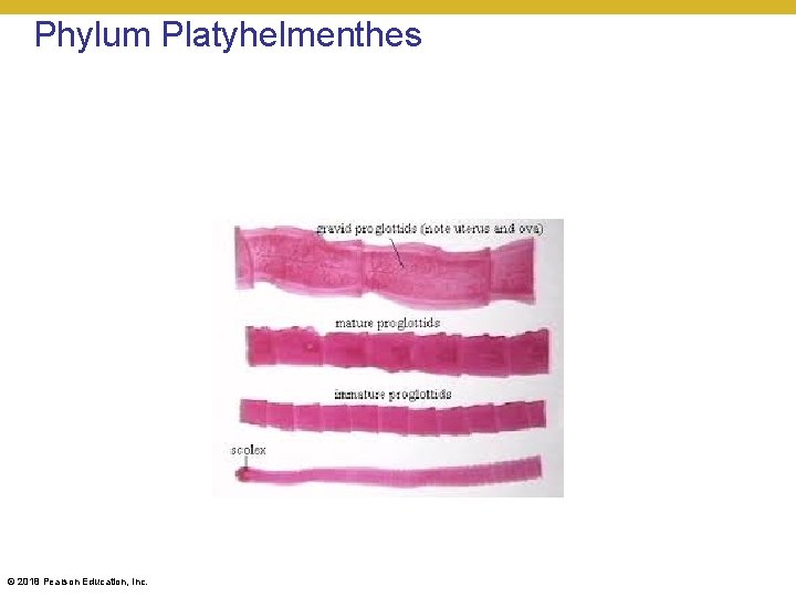 Phylum Platyhelmenthes © 2018 Pearson Education, Inc. 