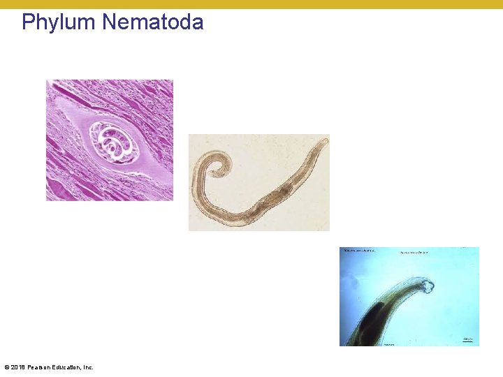Phylum Nematoda © 2018 Pearson Education, Inc. 