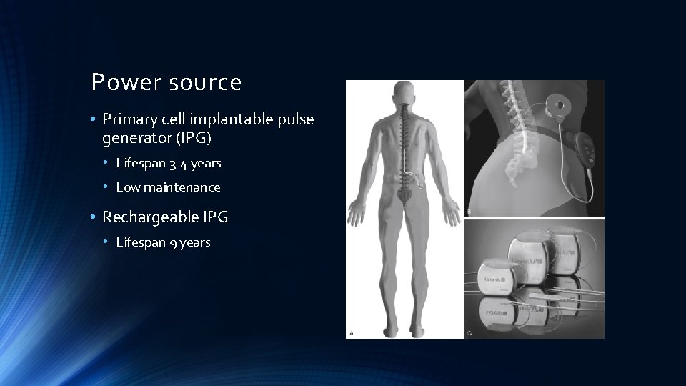 Power source • Primary cell implantable pulse generator (IPG) • Lifespan 3 -4 years