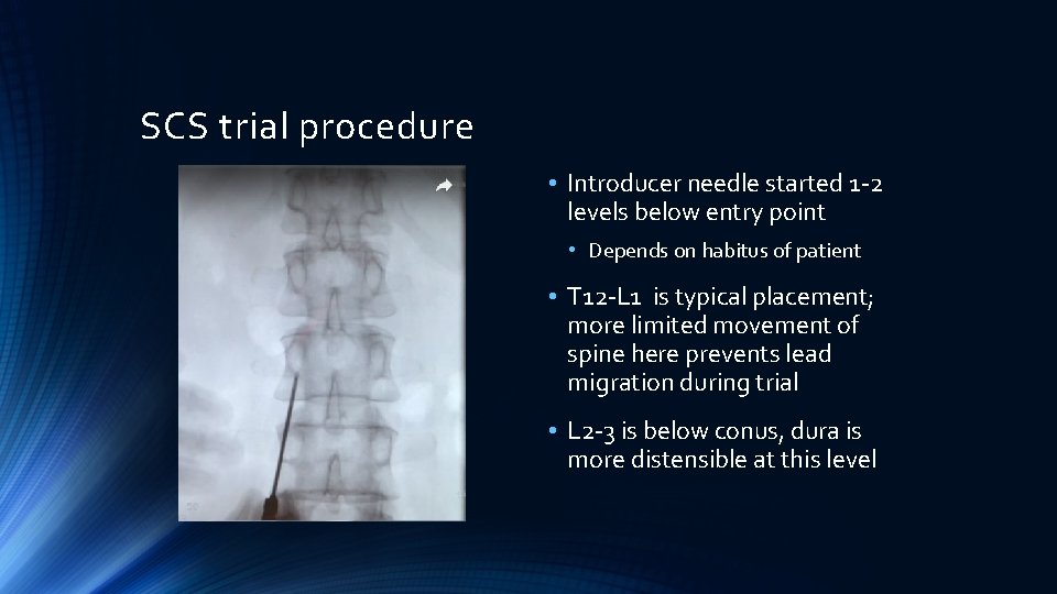 SCS trial procedure • Introducer needle started 1 -2 levels below entry point •