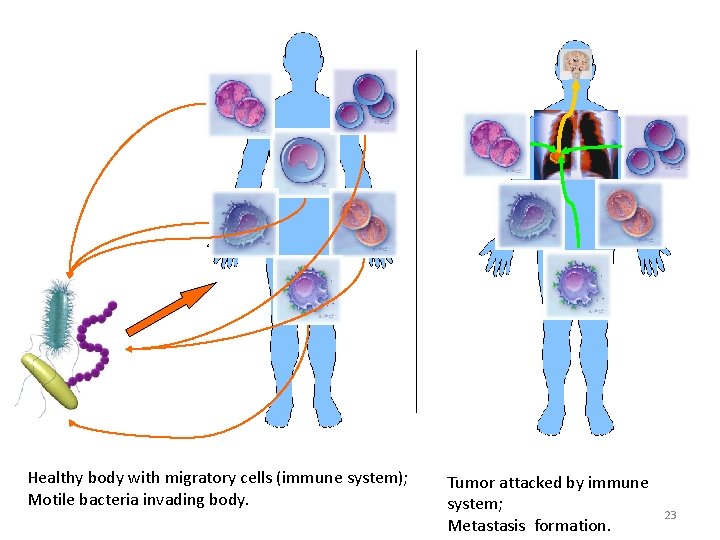 Healthy body with migratory cells (immune system); Motile bacteria invading body. Tumor attacked by