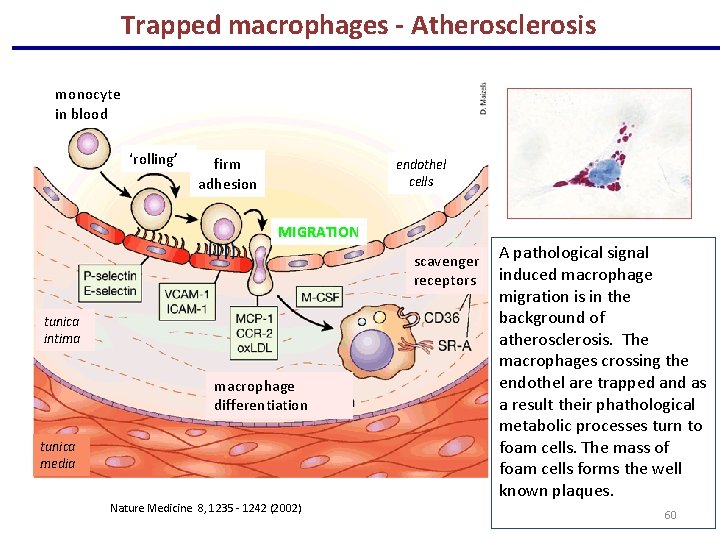 Trapped macrophages - Atherosclerosis monocyte in blood ‘rolling’ firm adhesion endothel cells MIGRATION scavenger