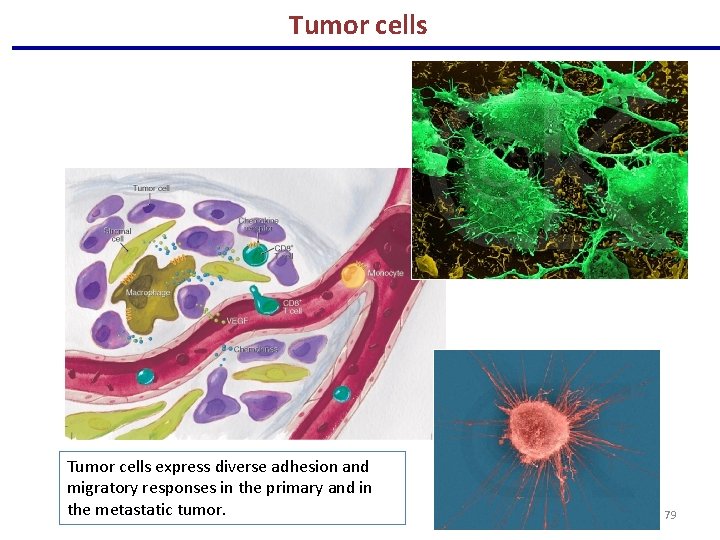 Tumor cells express diverse adhesion and migratory responses in the primary and in the